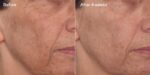 سرم روشن کننده ویتامین سی و گلیکولیک اسید مورد - Image 2