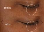ژل کرم دورچشم روشن کننده و‌ضدچروک استی لادر مدل Advanced Night Repair - تصویر 2