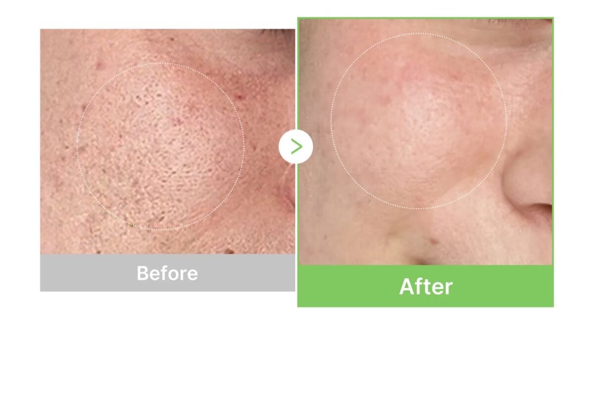 کرم مرطوب کننده ترمیم و تسکین‌دهنده مدی‌ کیوب مدل Exosome Cica - Image 2