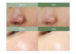 پاک‌کننده سبوم و جوش‌های سرسیاه دکتر التیا مدل Premium Quick Step Sebum - Image 4