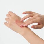 سرم ژلی روشن کننده و ضدلک آستاگزانتین دکتر ملاکسین - تصویر 3