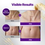 کرم لیفت و سفت کننده سه بعدی طلا نامبوزین مدل NAD+ Gold 3D Firming - تصویر 2